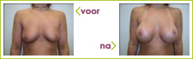 l de vries ervaring