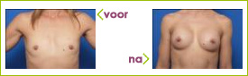 l de vries ervaring