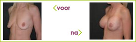 l de vries ervaring