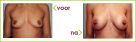 l de vries ervaring