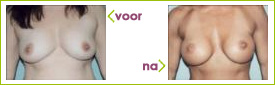 l de vries ervaring